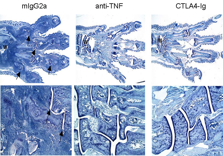 CIA Therapeutic treatment with anti-TNF and CTLA4-Ig &ndash; Histological analysis